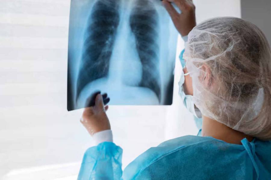 Concluyeron las medidas de cuarentena en la región rusa de Irkutsk tras la muerte de una laboratorista
